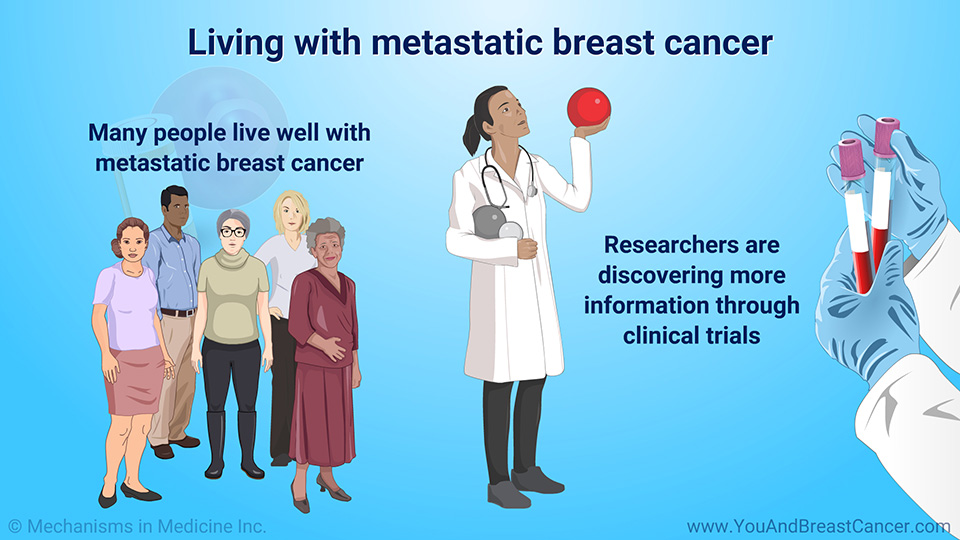 Living with metastatic breast cancer