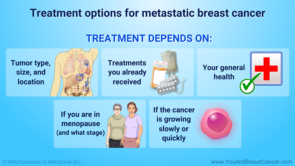 Treatment options for metastatic breast cancer