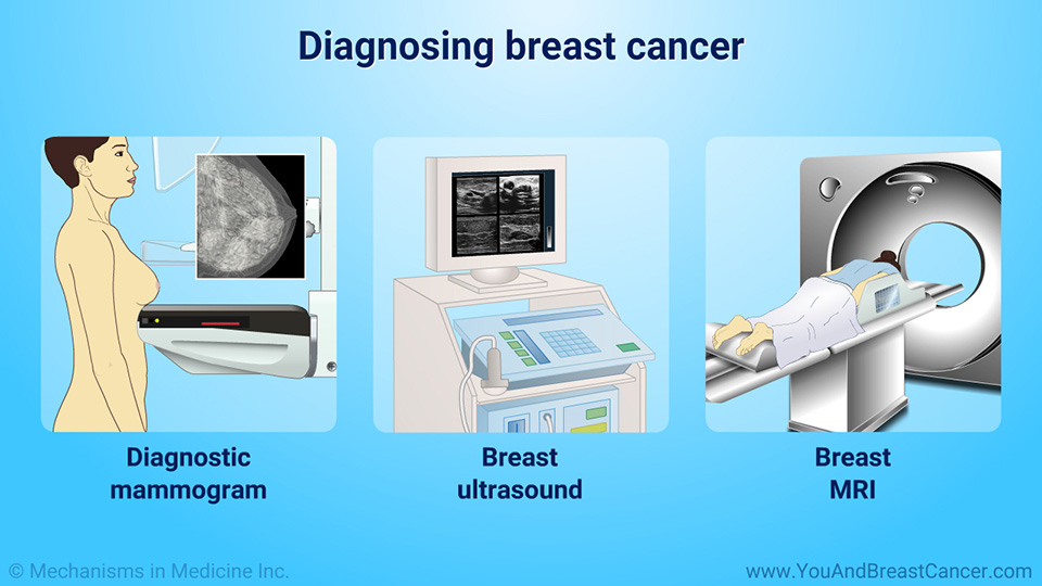 Diagnosing breast cancer
