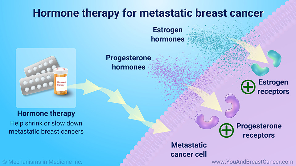 Hormone therapy for metastatic breast cancer