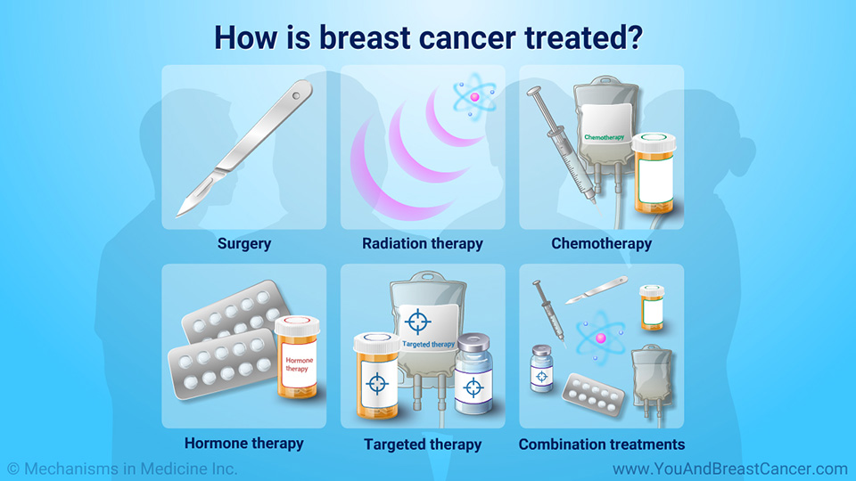 How is breast cancer treated?