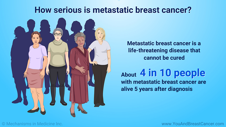 How serious is metastatic breast cancer?