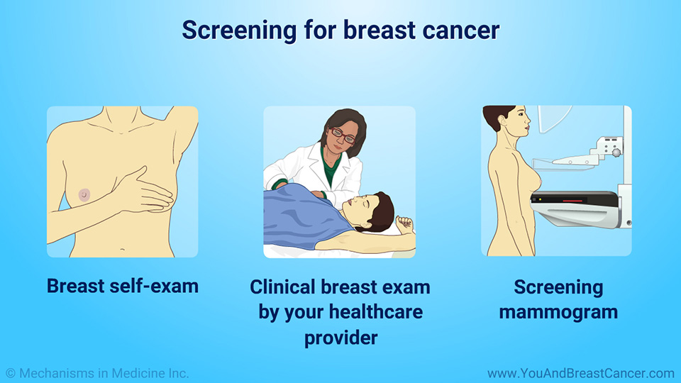 Screening for breast cancer