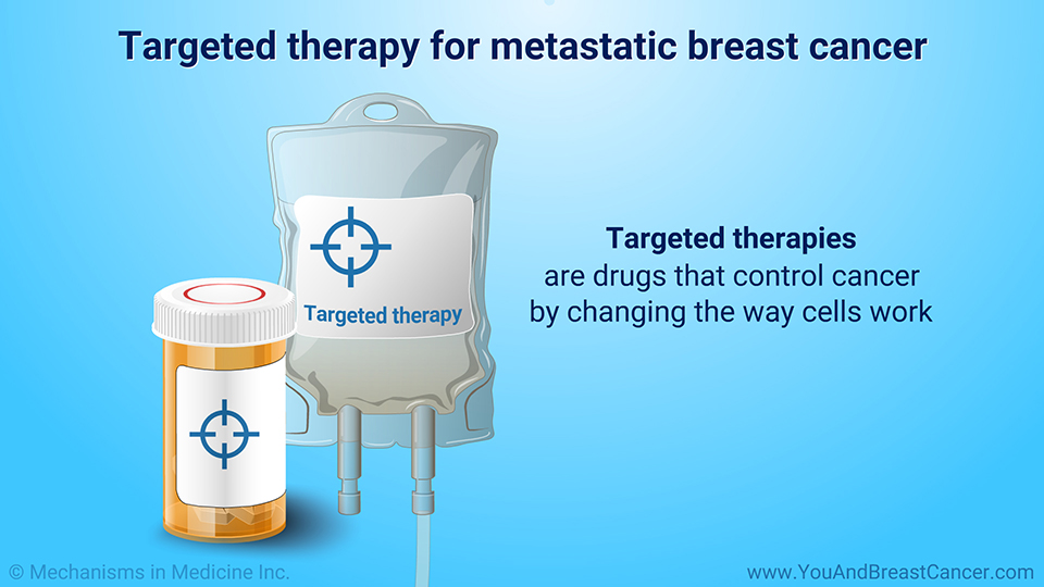 Targeted therapy for metastatic breast cancer