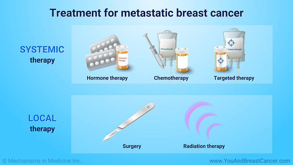 Treatment for metastatic breast cancer