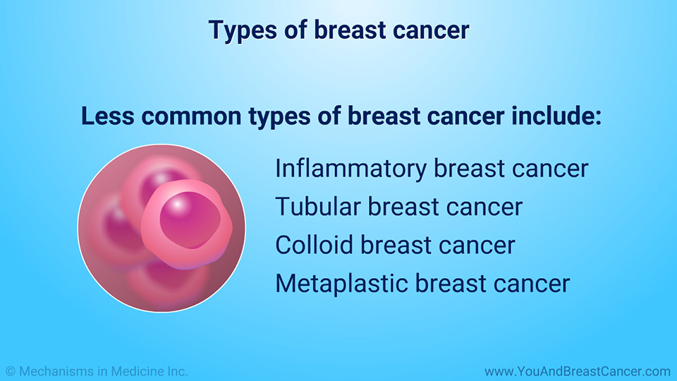 Types of breast cancer