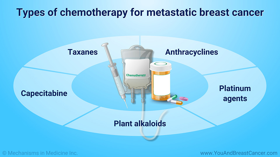 Types of chemotherapy for metastatic breast cancer
