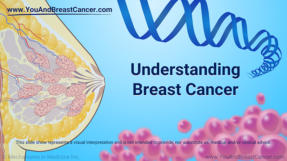 Slide Show - Understanding Breast Cancer